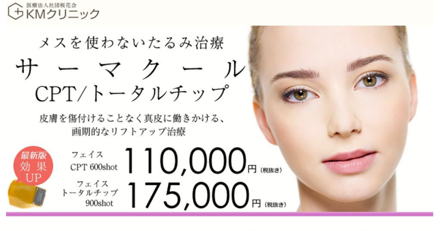 KM新宿クリニックのサーマクール施術の口コミ体験談！痛みや料金プランも解説します