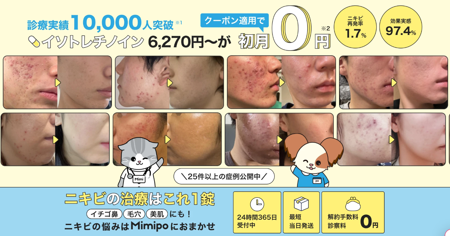 Mimipoオンラインクリニックのニキビ治療の口コミ評判！イソトレチノイン治療！