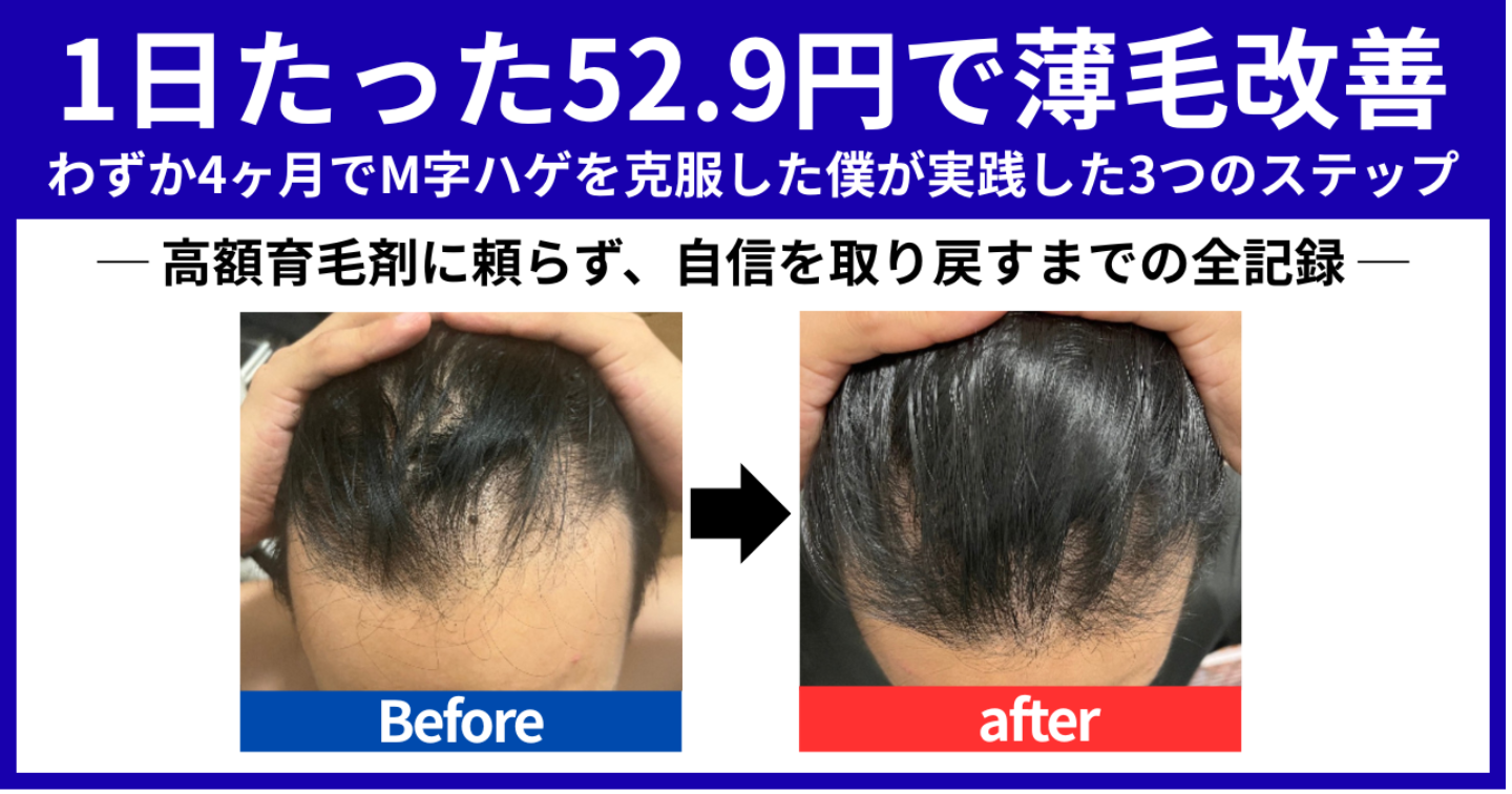 まだ若いのに髪が薄くなり、自信を失いかけていませんか？